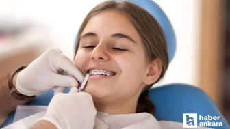 Ortodonti tedavisine başlayacak çocuklar için uzman isim doğru zamanı açıkladı!